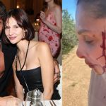 Can Yaman'ın Sevgilisi Kanlar İçinde: "Artık Susmayacağım"