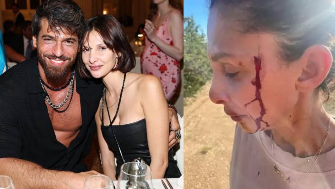 Can Yaman'ın Sevgilisi Kanlar İçinde: "Artık Susmayacağım"