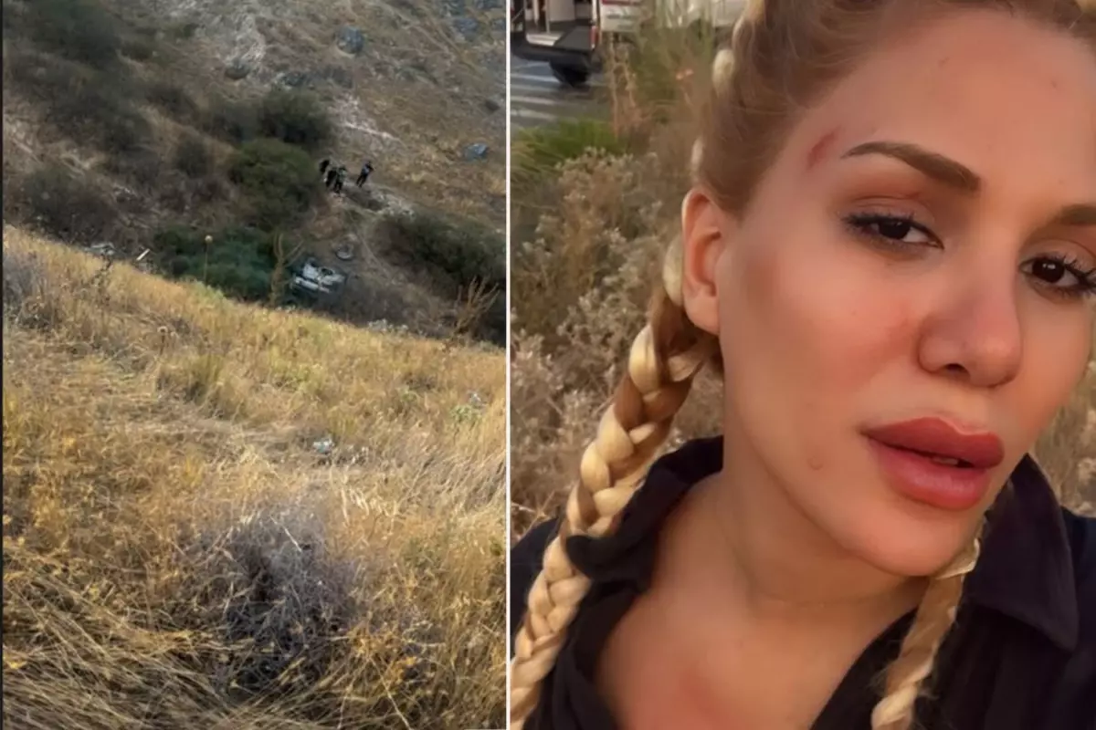 Survivor Almeda Baylan Korkunç Kaza Geçirdi: Ölümden Döndü!