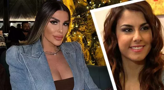 Tuğçe Özbudak’tan Estetik İtirafı: “Pişman Değilim”